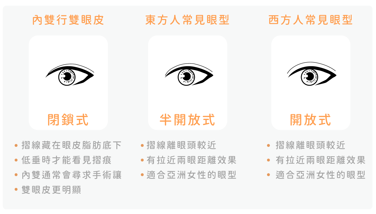 雙眼皮類型介紹